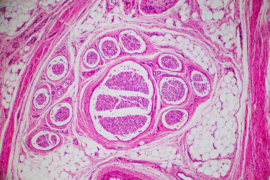 Sweat gland in human skin