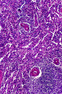 Central antery hyaline degene of human spleen