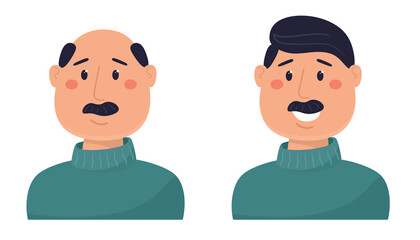 A man with hair and balding. Vector illustration in flat style.