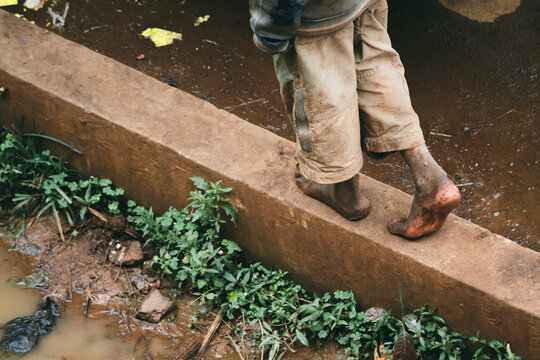 Detail Of Poor Boy Bare Feet Walking On A Curb