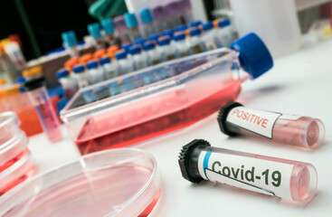 Vial pcr of SarsCov2 coronavirus, conceptual image