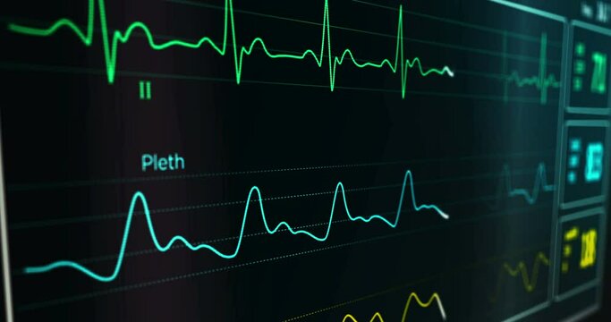 ECG heart beat rate cardio monitor in hospital. EKG electrocardiogram, respiration and SPO2 oxygen saturation medical examination. Patient cardiac monitoring. Heartbeat display loopable seamless anima
