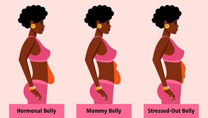 Types of female tummies for African American women. Menopausal hormonal belly, bloating belly and stressed-out belly. Vector illustration
