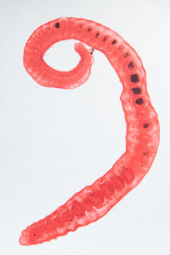 worm larva, micrograph.