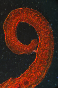 worm larva, micrograph.