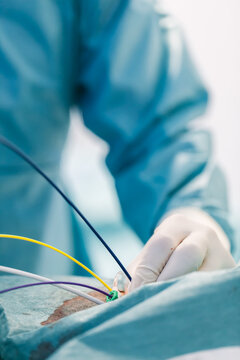 Surgeon Working with a Catheter in the Operating Room