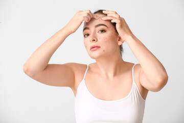 Fototapeta premium Young woman with acne problem squishing pimples on white background