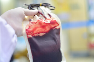 Close up blood bag in laboratory.