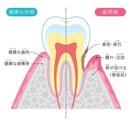 Tooth cross section_12