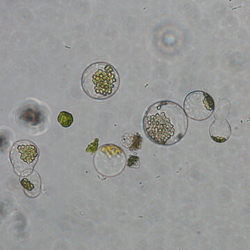 protoplast of plant