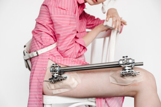 Crop model with external fixation rods sitting on chair