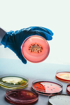 Woman hand holding a microbiology culture