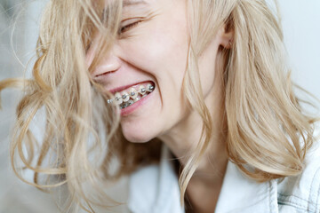 Young woman with braces