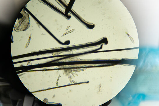 Top view of hair with small parasites placed under lens of modern microscope in laboratory