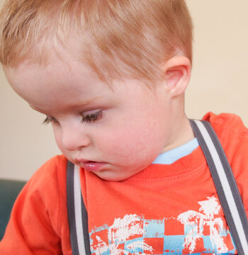 Little Boy with Down Syndrome Looking Downwards