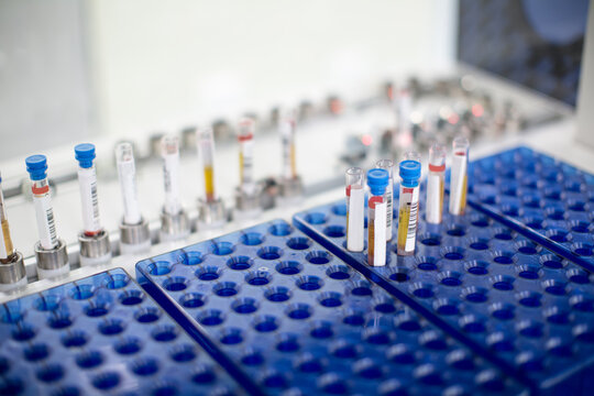 Close up of pipette tips in hospital laboratory