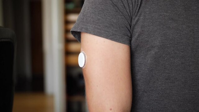 Close up of a young and healthy man with diabetes, using his phone to check his blood glucose level with a sensor on his arm. Phone display towards the arm.
