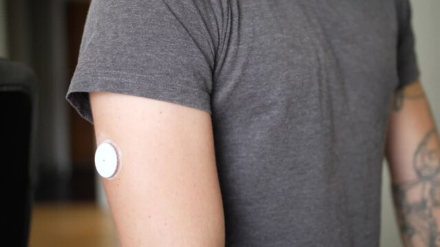 Close up shot of a young man with diabetes checks his blood glucose levels in his home with his smartphone and glucose reading sensor on his arm. Phone display is towards the arm.