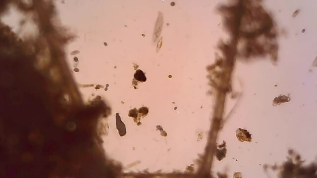 Microscope Freshwater Pond Algae and Plankton Paramecium 1200x