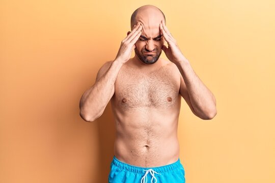 Young handsome bald man wearing swimwear shirtless with hand on head, headache because stress. suffering migraine.