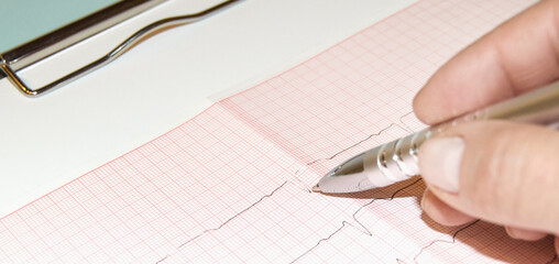 healthcare and medical concept - female doctor hands studies cardiogram holding pen