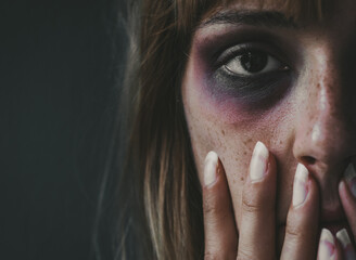 Beaten woman standing in front of a dark wall demonstrating violence on women. - obrazy, fototapety, plakaty