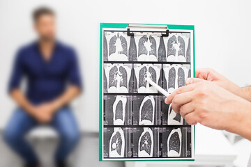 Pulmonologist showing CT scan of lungs patient with pulmonary fibrosis, after recovery, lung disease