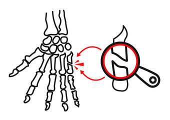 
Body anatomy, wrist bone