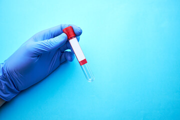 person holding empty blank blood collection tube. medical research and analysis conceptual. studio shot. minimal