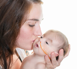 Close up young mother kissing cheek of special needs infant with feeding tube - 381229716