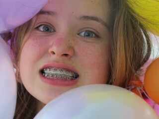 close up portrait of a girl  with braces