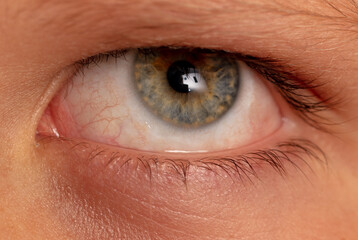 Close-up of a boy's eye.