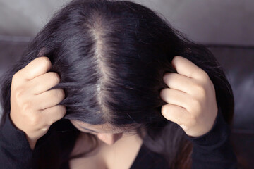 A woman has hair problems, she has hair loss.