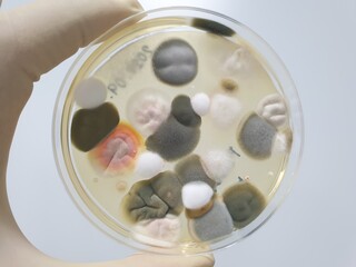Fototapeta na wymiar Results of culture of various fungal bacteria