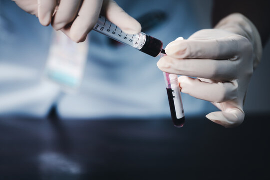 Close up of doctor hand holding blood sample test . Medical concept image