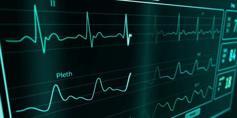 ECG Cardiac heart rate monitor in hospital