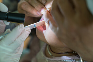 Volunteer nurse performing medical examination on poor Asian children