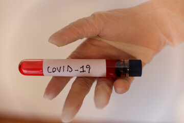 Test tube for covid 19