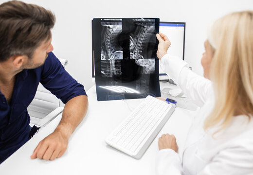 Neurologist considers and discusses with man patient an X-ray image of his cervical spine. Diagnostics and treatment of cervical osteochondrosis of spine