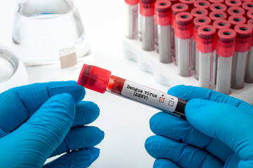 Studying clinical research and microbiology result concept with doctor in latex gloves holding test tube with blood testing positive for dengue virus in scientific lab with laboratory flasks and tubes