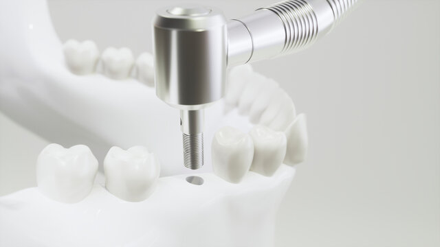 VCAD Dental Outsourcing Workflow