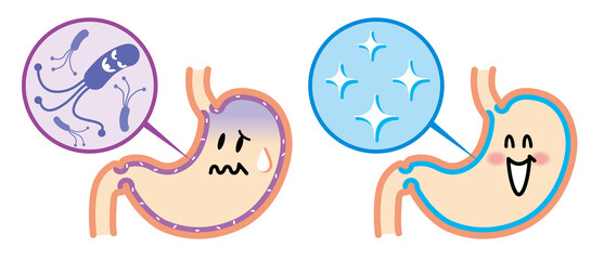 ピロリ菌に感染した胃と健康な胃　