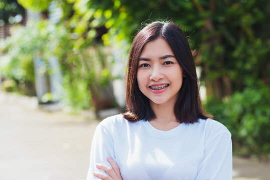 Portrait of Asian teen beautiful young woman smile have dental braces on teeth laughing outdoor, Medicine and dentistry concept