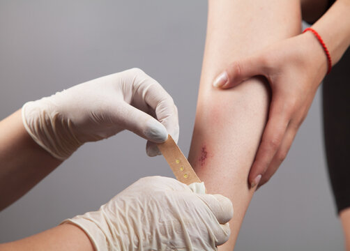 Pediatrician Sticking Court Plaster On Girl Wound.