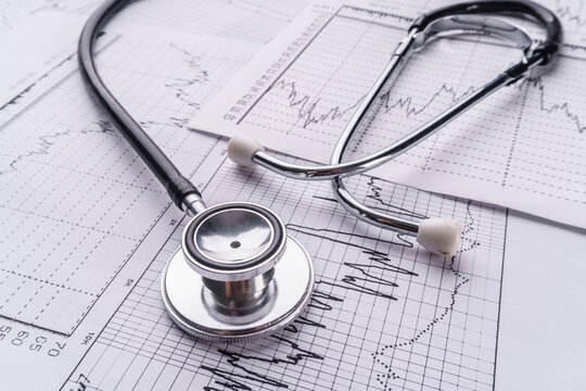 Stethoscope and cardiogram, medical concept.