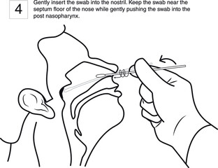 Gently insert the swab into the nostril. Keep the swab near the septum floor of the nose while gently pushing the swab into the post nasopharynx. step 4, line drawing