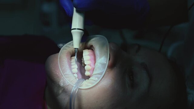 Woman at the dentist's office, close-up of brushing teeth from tartar, the dentist uses ultrasound.