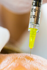 Stirnfalte bei Frau reduzieren