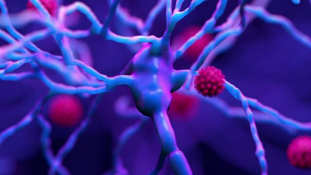 How COVID-19 can damage the brain, the deterioration of myelin a fatty coating that protects neurons