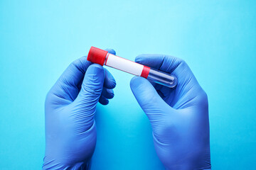 person holding empty blank blood collection tube. medical research and analysis conceptual. studio shot. minimal